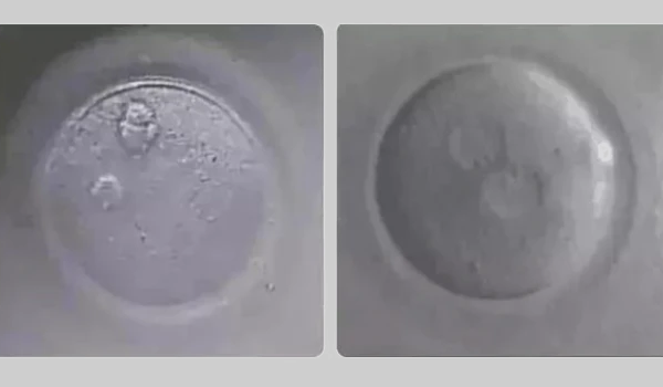 胚胎移植并非都能一次就成功，这3大条件不可或缺！