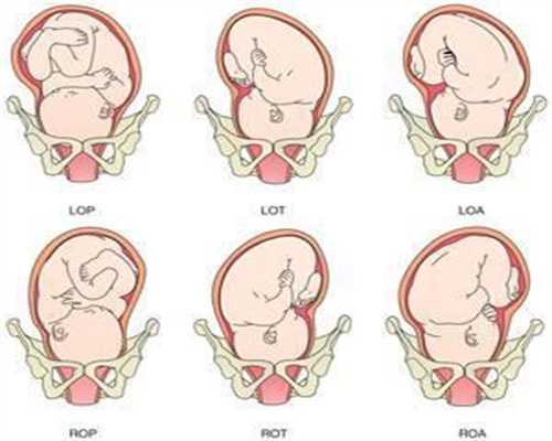 孕期腹泻怎么办 试试“卵巢早衰可以移植吗三粥”调理