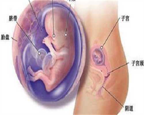 试管孕早期出血10多天孕妇用她的阑尾来考验你的医德