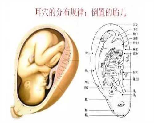 广州代怀孕医院_怀孕初期肠痉挛的影响是什么