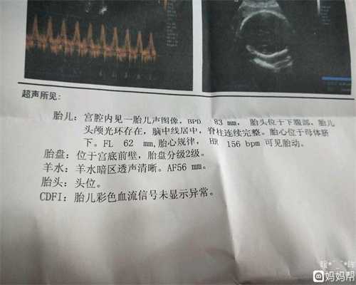 广州供卵试管一对一咨询_供卵试管医院多少钱_代怀孩